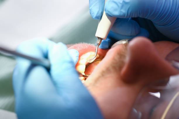 Best Emergency Treatment for Toothache in Burlington, KS