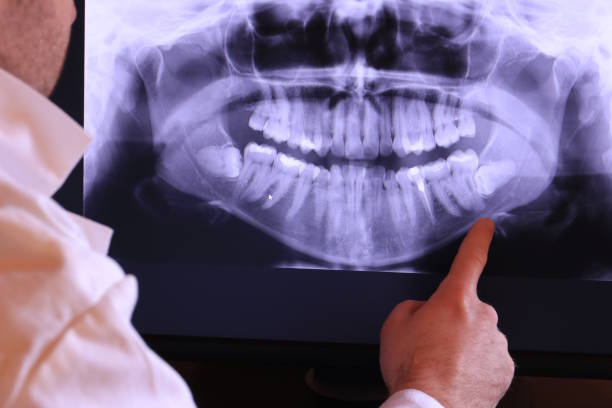 Best Pediatric Emergency Dentist in Burlington, KS