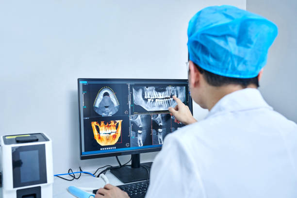 Best Emergency Wisdom Teeth Removal in Burlington, KS