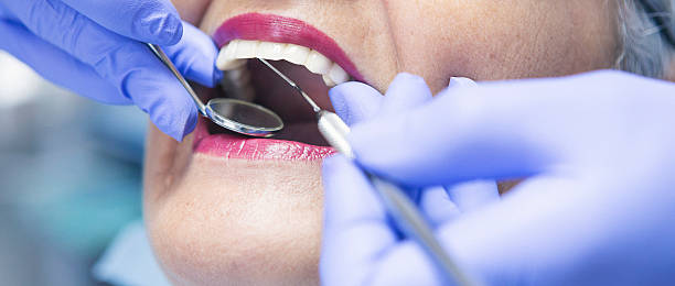 Best Emergency Tooth Extraction in Burlington, KS